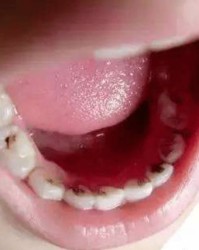 牙虫牙虫牙怎么组词