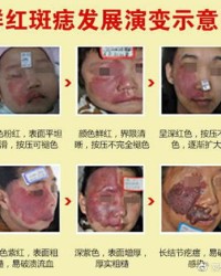 自闭的痣还能怎么组词