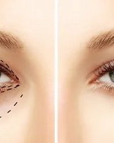 眼睛在前面怎么组词