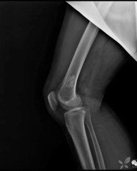 股骨骨头的骨怎么组词