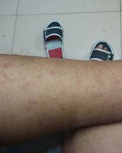 上身发痒怎么组词呀