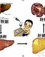 脂肪肝怎么组词啊