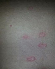 上身发痒怎么组词