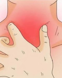 咽喉炎的炎怎么组词