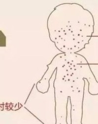 疹子的疹组词怎么组