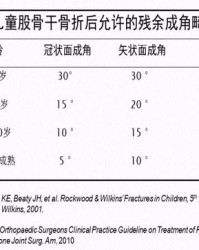 股骨折怎么组词