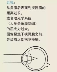 眼睛的组词怎么说呀