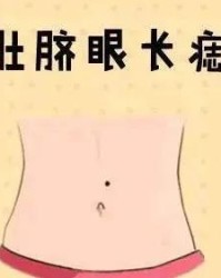 痣怎么可以组词