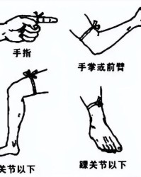 伤伤口的伤怎么组词