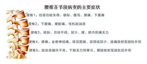 退腿怎么组词