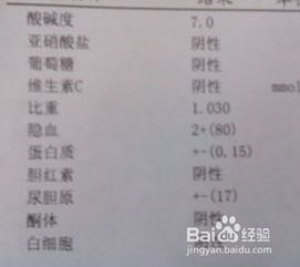 尿检怎么组词
