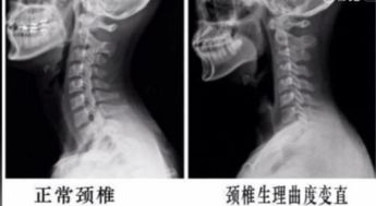 颈椎还可以怎么组词