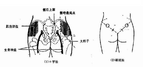 薄肌的肌怎么组词