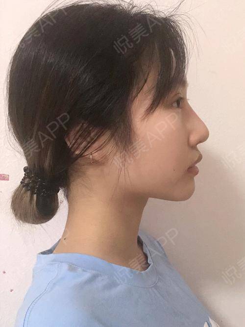 颧骨的颧还可以怎么组词