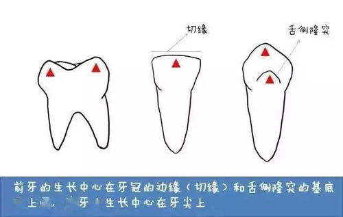 牙成怎么组词