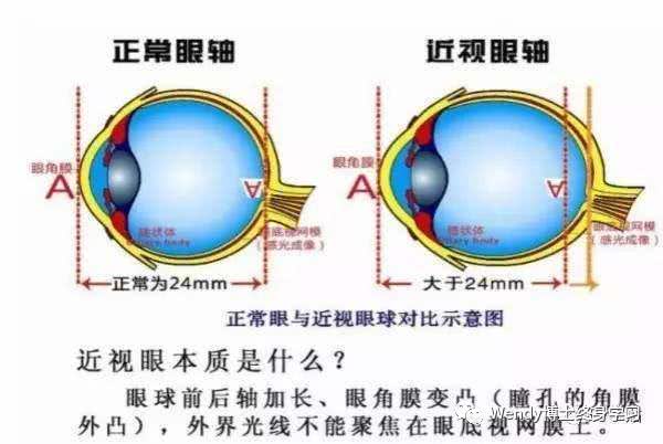 眼睛的近可以怎么组词