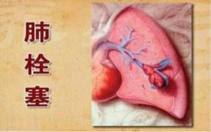 住组词怎么