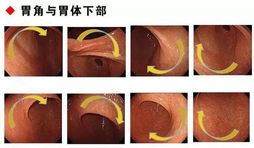 胃镜的镜怎么组词