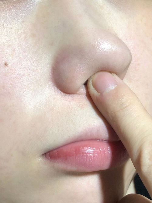 鼻子的鼻怎么组词