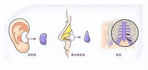 鼻子鼻怎么组词