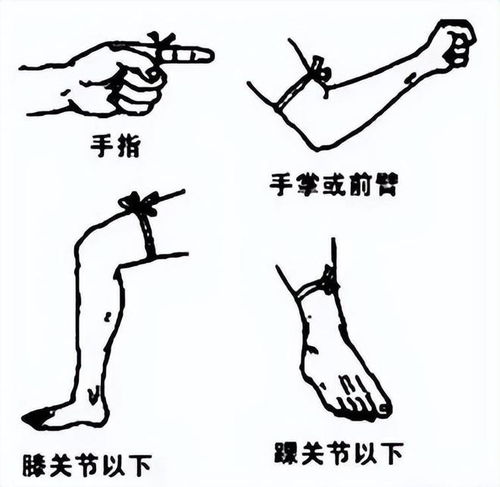 伤伤口的伤怎么组词