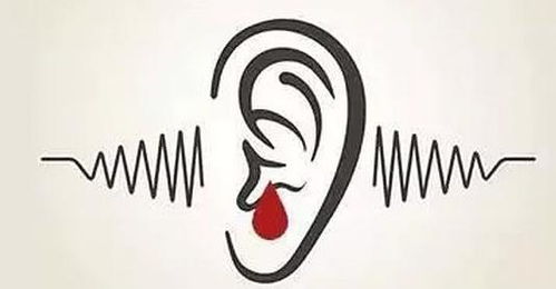 耳聋的胧怎么组词