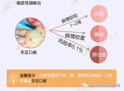 疱疹可以怎么组词