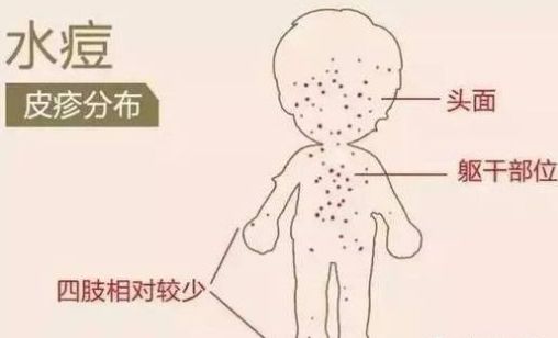 疹子的疹组词怎么组 疹子的疹组词怎么组