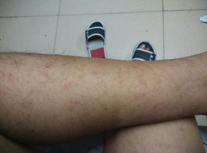 上身发痒怎么组词呀