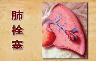 拴住的栓可以怎么组词 拴住的栓可以怎么组词