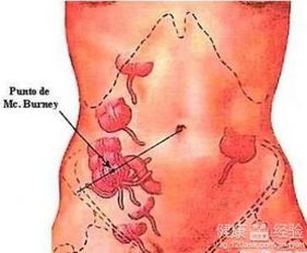 阑尾炎的炎怎么组词