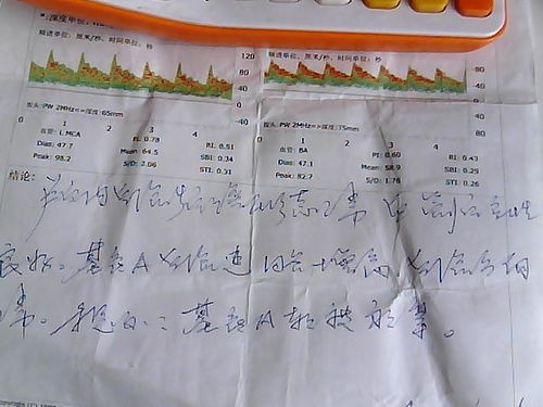 我头疼的疼怎么组词