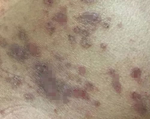 全身发痒怎么组词呀 全身发痒怎么组词呀