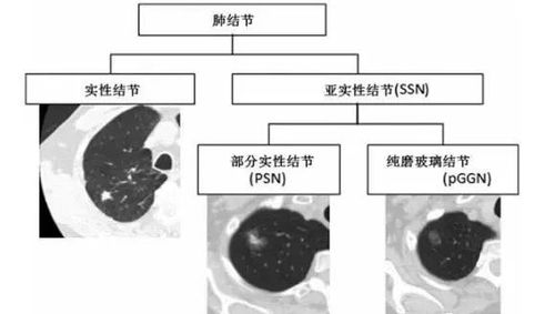 了解的结节怎么组词