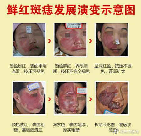 自闭的痣还能怎么组词 自闭的痣还能怎么组词