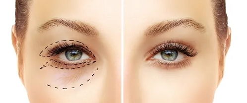 眼睛在前面怎么组词 眼睛在前面怎么组词