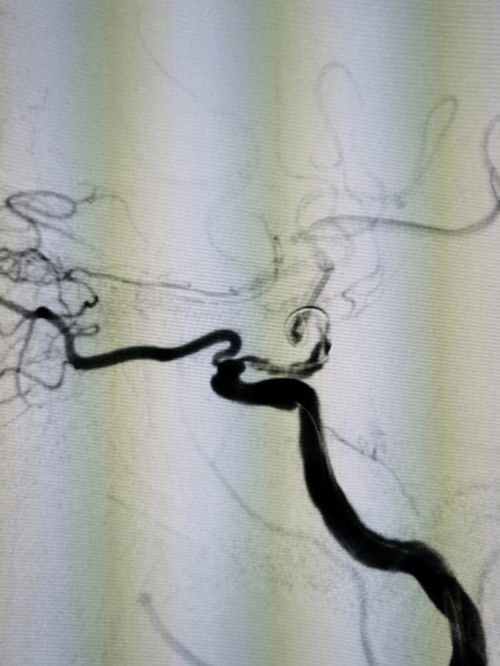 膨颅怎么组词 膨颅怎么组词