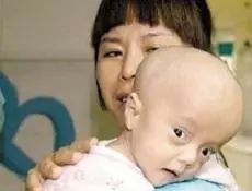 膨颅怎么组词 膨颅怎么组词