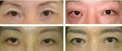 眼睑的睑怎么组词