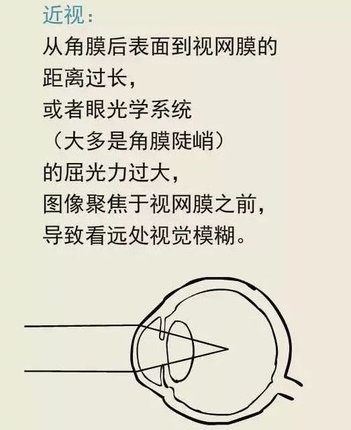 眼睛的组词怎么说呀