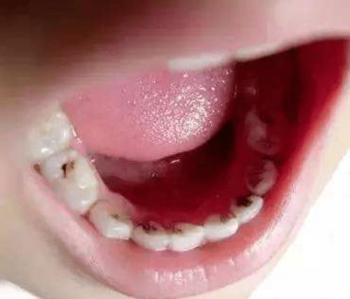 牙虫牙虫牙怎么组词 牙虫牙虫牙怎么组词