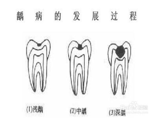 牙虫牙虫牙怎么组词 牙虫牙虫牙怎么组词