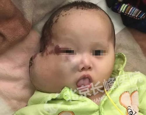 请问脸上的瘤怎么组词