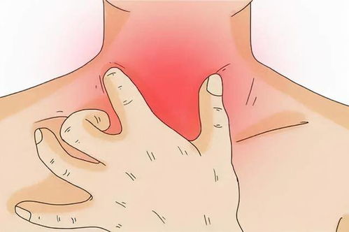 咽喉炎的炎怎么组词