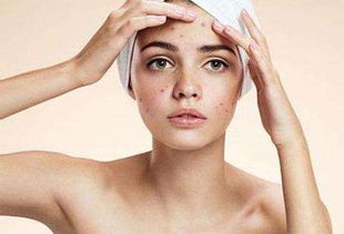 长痘痘该怎么组词