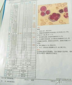 骨髓的谁怎么组词 骨髓的谁怎么组词
