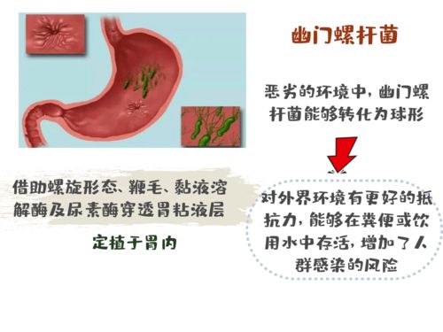格外食道癌怎么组词的简单介绍