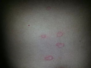 上身发痒怎么组词