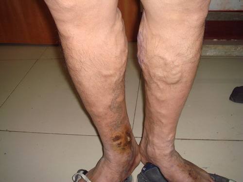 下肢怎么组词 下肢怎么组词