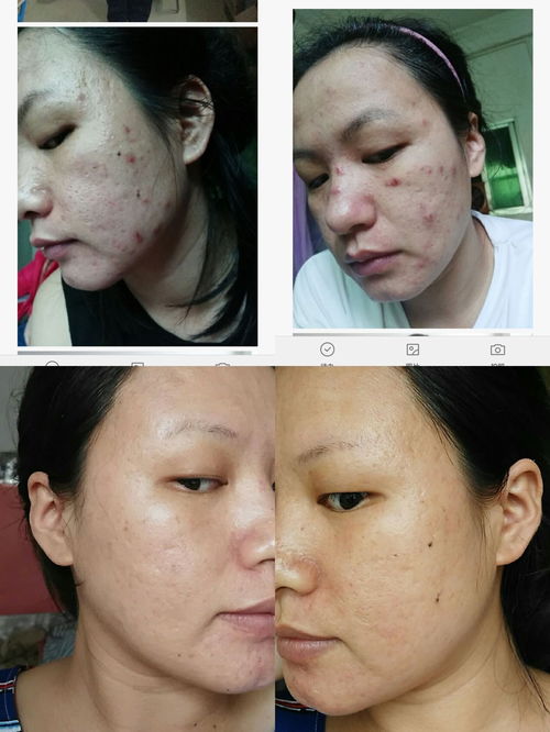 痘痘不怎么组词